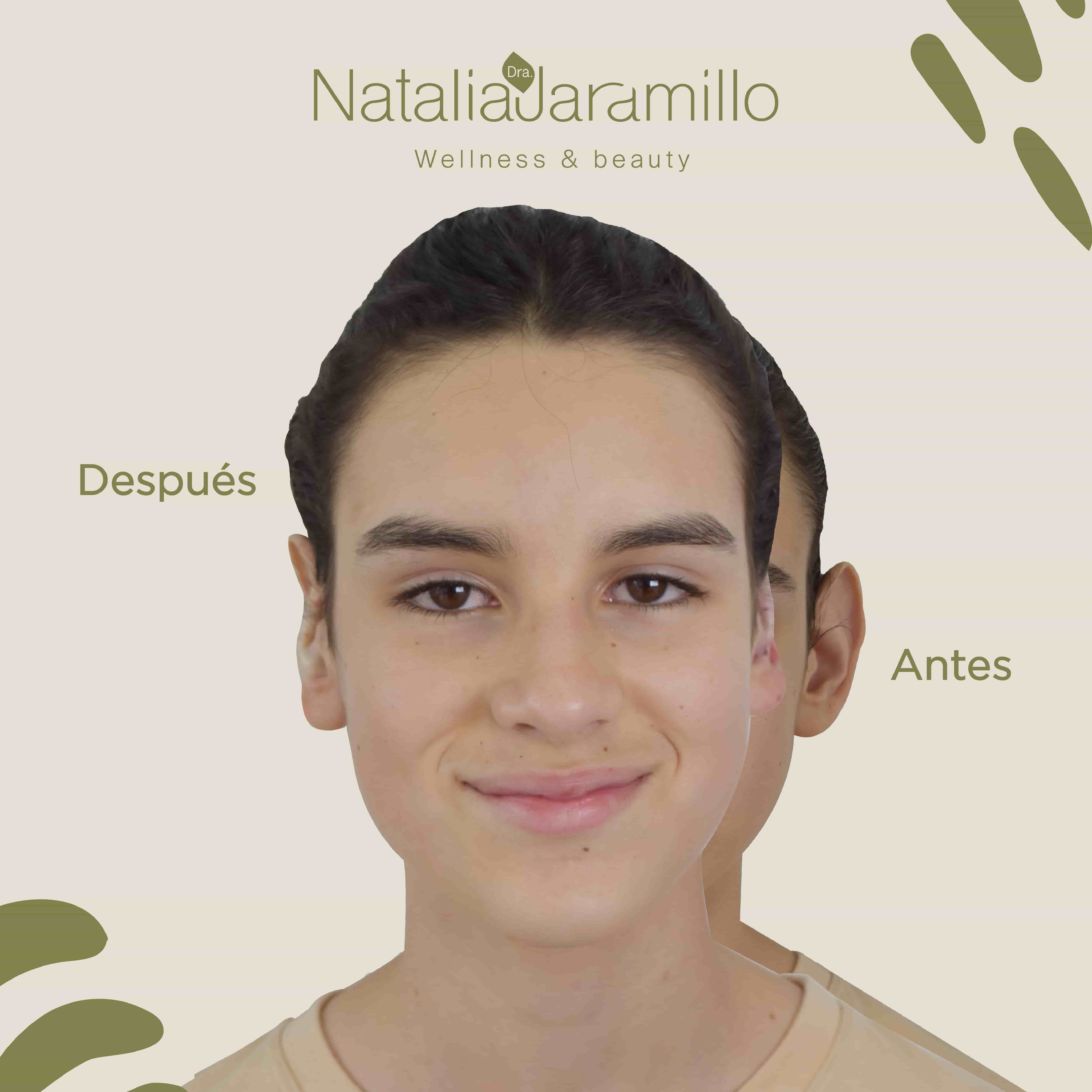 "Dios les bendiga, de verdad que muchas gracias por todo. La vida de mi hijo dió un giro de 360 desde el procedimiento".