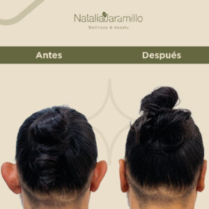 Quisiera comentar lo maravilloso que fue todo el proceso de otomodelación con la doctora Natalia Jaramillo y su equipo. La calidez humana fue mucha y me hicieron sentir demasiado bien.